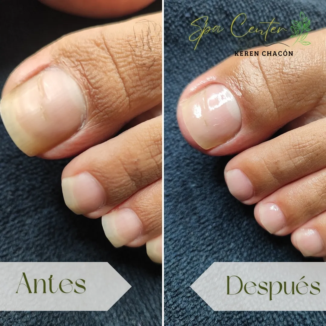 Circuito de Hidroterapia